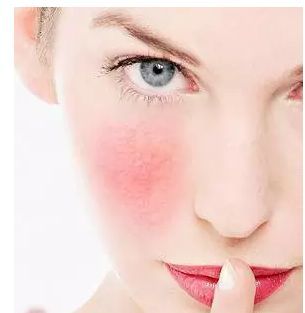 拿什么拯救你,紅血絲小姐 拿什么拯救你,紅血絲小姐